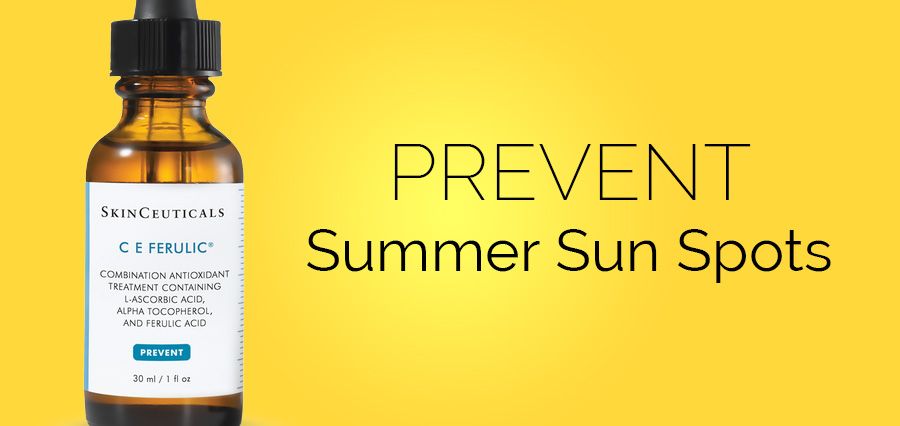 Preventing Summer Sun Spots