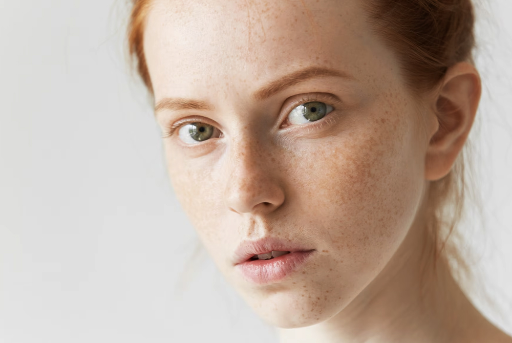 Uneven Skin Tone: An Overview
