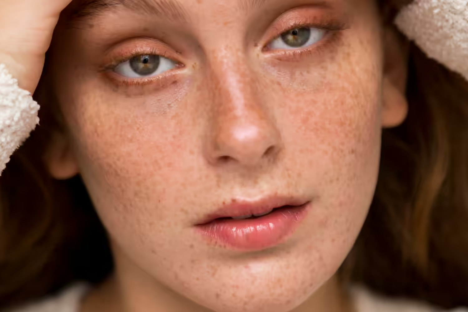 Brighten Your Complexion: Hyperpigmentation Fixes